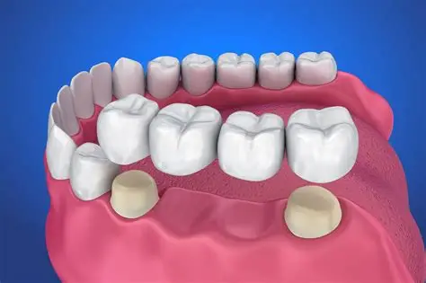 Dentures & Crowns Treatment